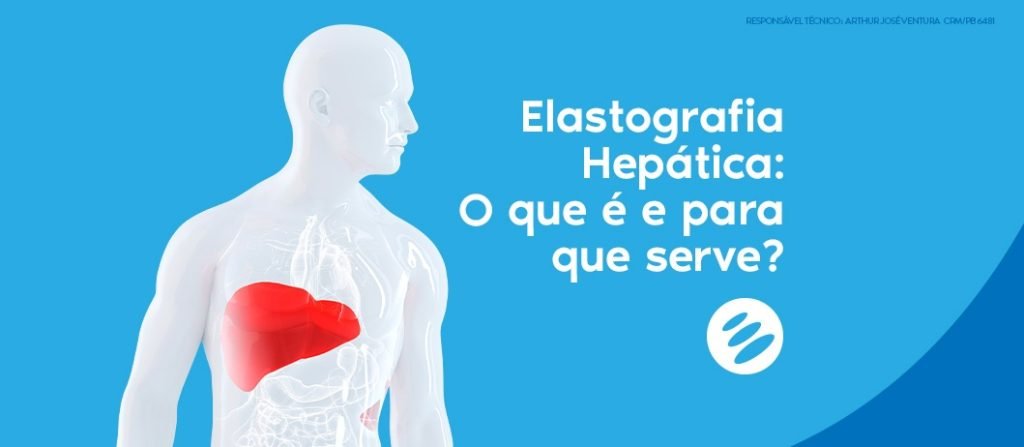 Elastografia Hep Tica O Que E Para Que Serve Imago Diagn Stico