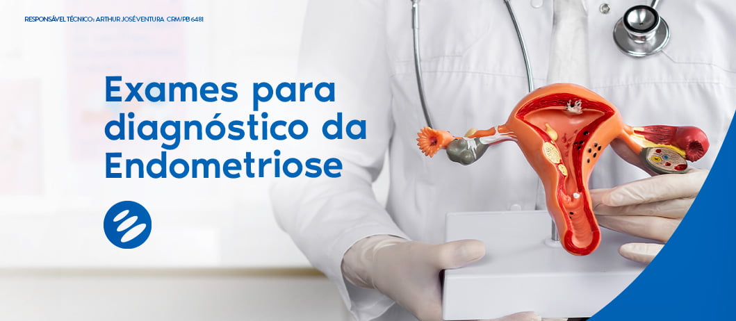 Conheça os principais exames de imagem para diagnóstico da Endometriose