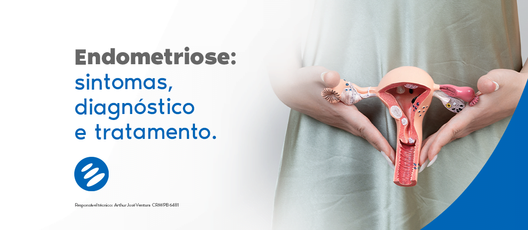 Endometriose: sintomas, diagnóstico e tratamento