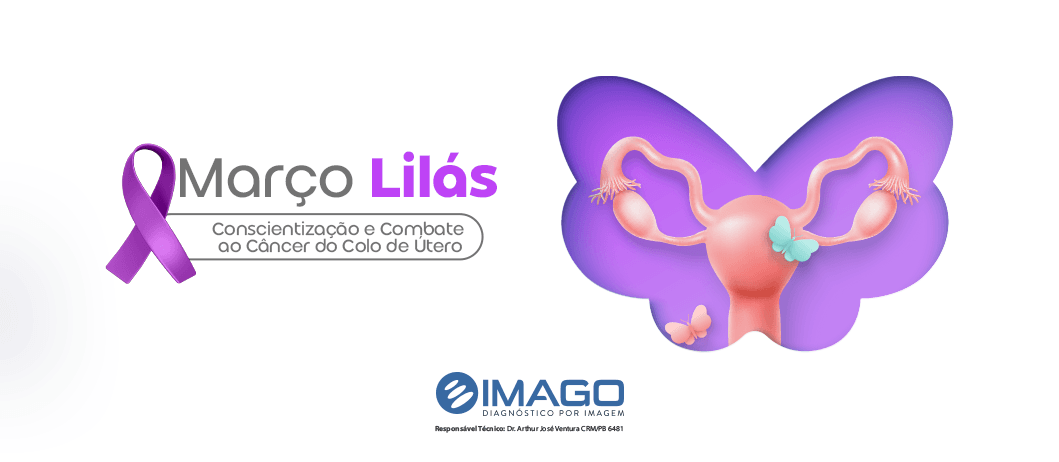 Prevenção é a maior aliada contra o Câncer do Colo do Útero