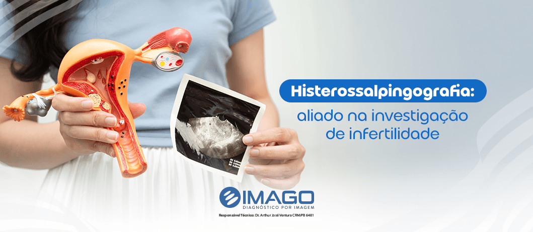 Histerossalpingografia: quando o exame é indicado?