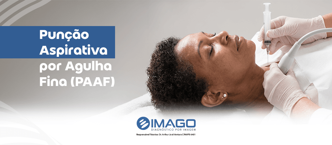 Quando é indicado a biópsia da tireoide?