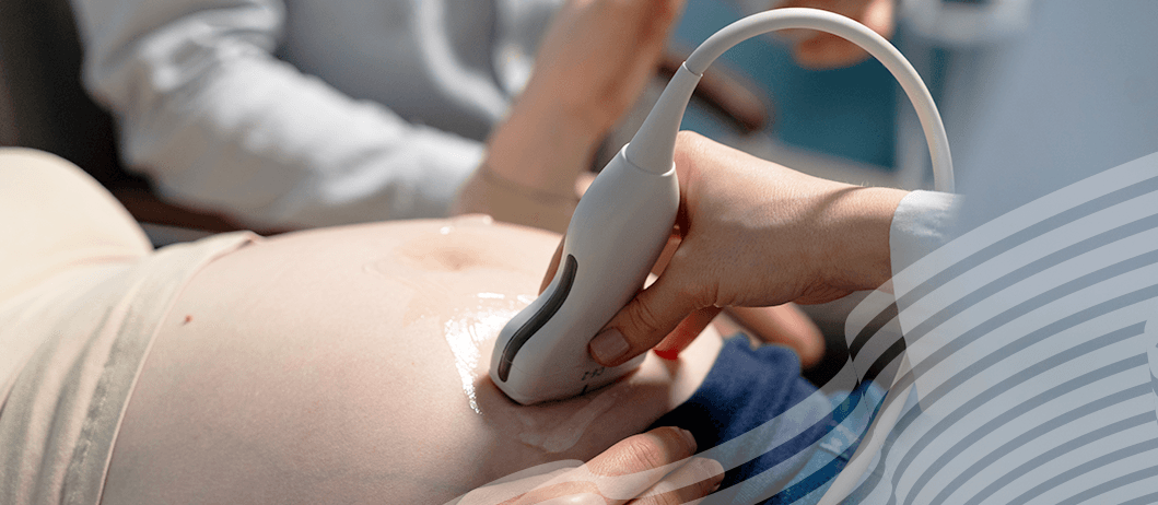 Translucência nucal: o que é e qual a importância desse exame na gestação?